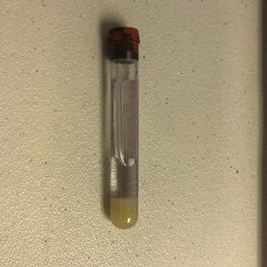 Meet your Posher, Arbenita